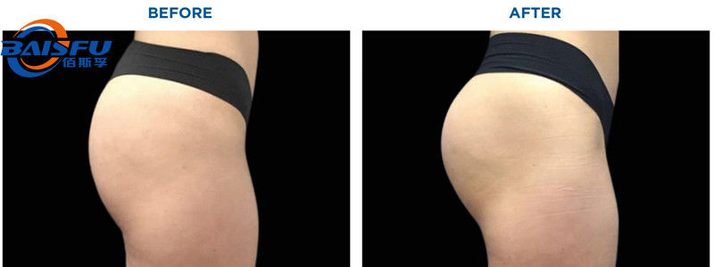 Baisfu Buttock Boosting Syrup For Butt Buttocks Hip Booster Syrup